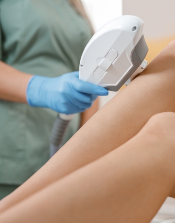 depilación laser