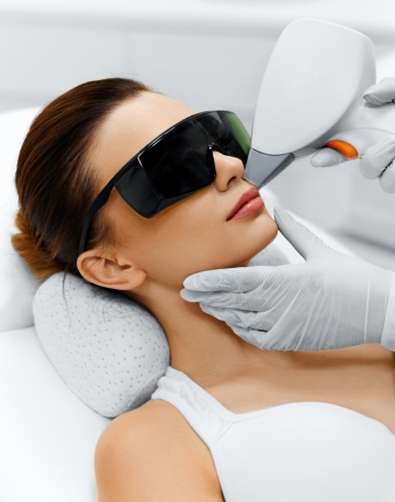 depilación laser